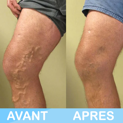 VivaPieds™ - Redonnez vie à vos pieds, libérez-vous de la douleur !